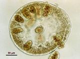 5 – Sezione trasversale a livello di un soro di tetrasporocisti